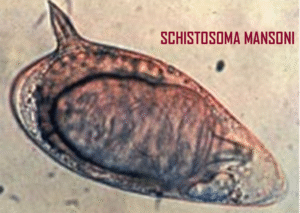 Parasitology Practice Questions: Schistosoma Mansoni
