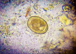 Parasitology Practice Questions: Ascaris