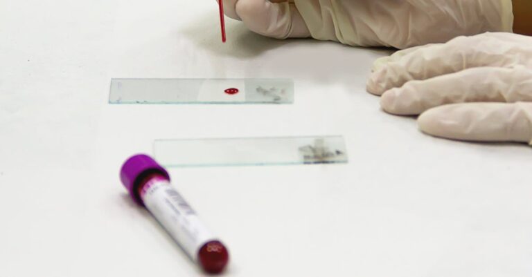 Haematology Practice Exam