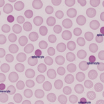 Spherocytes
